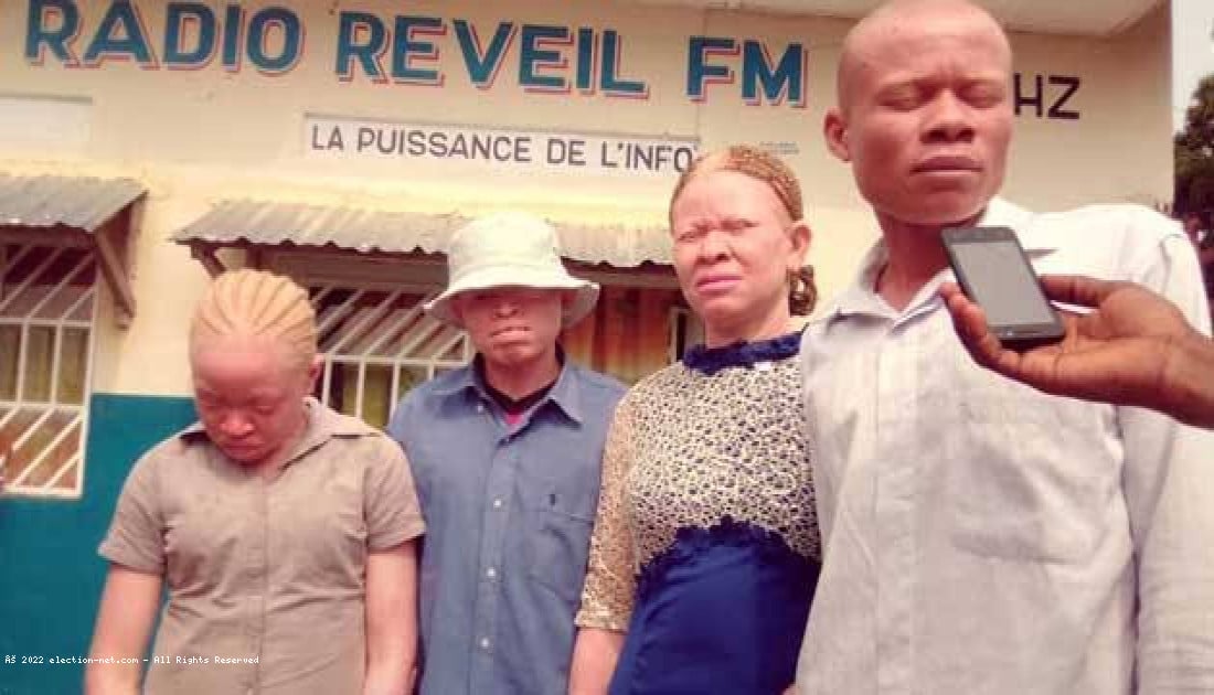 Kasaï-Central : le président d'une structure des albinos enlevé à Kananga
