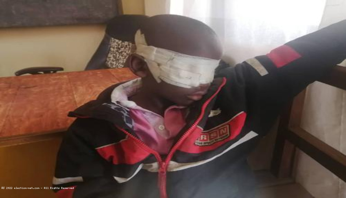 Bunia : accusé de sorcellerie, un enfant perd ses yeux après des tortures dans une église