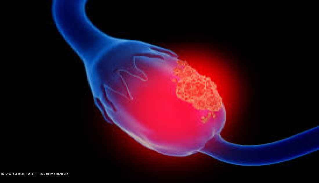 Cancers du sein et de l'ovaire : découverte d'un système de réparation de l'ADN