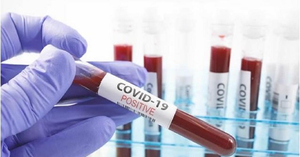 RDC/Covid-19 : 63 nouveaux cas notifiés, le cumul passe à 27.077